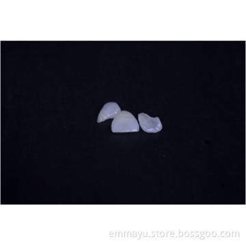Porcelain Ivoclar Ultra thin Veneer
